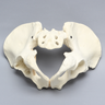 Pelvis with Global and Rim Defects, Full Male, Foam Cortical