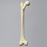 Femur with 10 Degree Varus Deformity