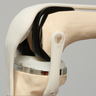 Total Knee Modular Demonstrator
