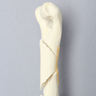 Canine Humerus with Spiral Fracture, Solid Foam