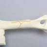 Canine Humerus with Spiral Fracture, Solid Foam