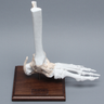 Foot and Ankle, Distal, Tendons and Ligaments with Stand