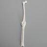 Knee, Pediatric, Solid White Plastic
