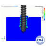 ENDPOINT Virtual Mechanical Test, Grade 20 Axial Pullout Strength