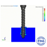 ENDPOINT Virtual Mechanical Test, Grade 20 Axial Pullout Strength