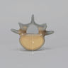 Lumbar L5, absolute™ 4th Gen. with 20 PCF Solid Foam Cancellous