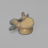 Lumbar L5, absolute™ 4th Gen. with 20 PCF Solid Foam Cancellous