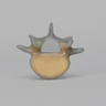 Lumbar L5, absolute™ 4th Gen. with 20 PCF Solid Foam Cancellous