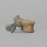 Lumbar L5, absolute™ 4th Gen. with 10 PCF Solid Foam Cancellous