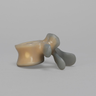 Lumbar L5, absolute™ 4th Gen. with 10 PCF Solid Foam Cancellous