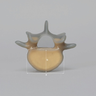 Lumbar L5, absolute™ 4th Gen. with 10 PCF Solid Foam Cancellous
