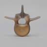 Lumbar L3, absolute™ 4th Gen., 10 PCF Solid Foam Core, Large