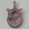 Thoracic T12, absolute™ 4th Gen., Large