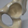 Hemi Pelvis, absolute™ 4th Gen., 17 PCF Solid Foam Core, Large