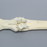 Equine Metacarpal III with Condylar Fracture