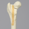 Canine Femur with Four-Part Comminuted Fracture