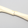Canine Femur with Midshaft Transverse Fracture