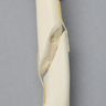 Canine Femur with Short Oblique Fracture