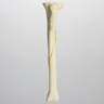 Canine Tibia with Spiral Fracture, Foam Cortical