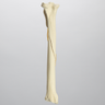 Canine Tibia with Spiral Fracture, Foam Cortical