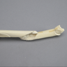 Canine Tibia with Long Spiral and Medial Malleolar Fractures, With Vise Attachment
