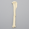 Canine Tibia with Midshaft Butterfly Fracture