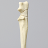Canine Ulna with Three-Part Olecranon Fracture, Solid Foam