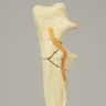 Canine Ulna with Comminuted Olecranon Fracture, Solid Foam