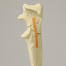 Canine Ulna with Comminuted Olecranon Fracture, Solid Foam