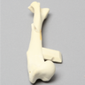 Canine Humerus with Distal Spiral and Medial Spike Fracture, Foam Cortical