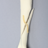 Canine Humerus with Long Oblique Fracture, Foam Cortical