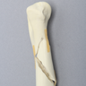 Canine Humerus with Distal Diaphyseal Butterfly Fracture, Foam Cortical