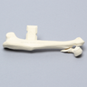 Canine Humerus with Distal Condylar Fracture, Foam Cortical