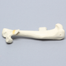 Canine Humerus with Distal Condylar Fracture, Foam Cortical