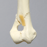 Canine Humerus with Distal "Y" Fracture, Foam Cortical, Right