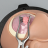 Standard Cranial Access Model