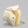 MagneFAST Humeral Head Insert