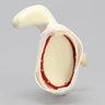 MagneFAST Glenoid Insert