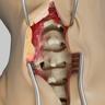 Cervical Spine, Encased Partial Head