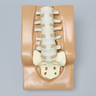 Lumbar Holder for Anterior Approach, Without Muscle Structure