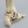 High Fidelity Ankle with Bones and Ligaments in Soft Tissue
