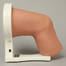 STIKâ„¢ System for Knee