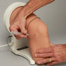 STIKâ„¢ System for Knee