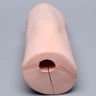 Knee Replacement Tissue, Arthroscopy