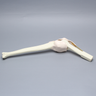 Knee Insert without ACL, Arthroscopy