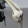 Knee, Arthroscopy