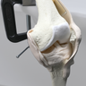 Knee, Arthroscopy