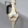 Knee, Arthroscopy
