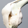 Knee, Arthroscopy