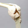 Knee, Arthroscopy